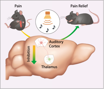 低强度声噪比通过抑制谷氨酸神经元到丘脑投射缓解小鼠疼痛.png