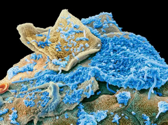 口腔微生物群会让人变胖吗？