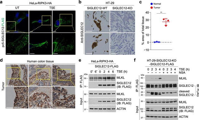 SIGLEC12介导坏死性细胞死亡过程中的质膜破裂—小柯机器人—科学网